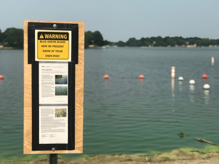 Warning sign for presence of blue green algae at beach.